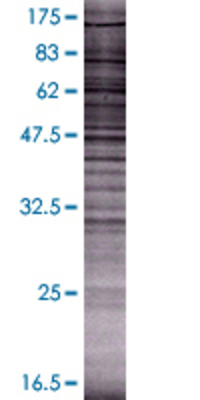 DKKL1 transfected lysate.