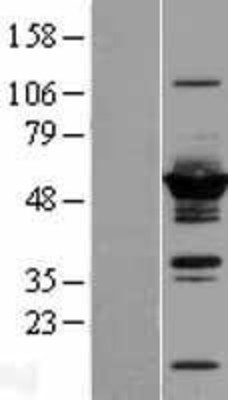 Western Blot: DYNC1LI2 Overexpression Lysate (Adult Normal) [NBL1-10068] Left-Empty vector transfected control cell lysate (HEK293 cell lysate); Right -Over-expression Lysate for DYNC1LI2.