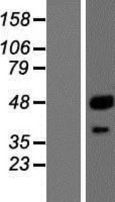 Western Blot: Cathepsin A Overexpression Lysate (Adult Normal) [NBL1-09586] Left-Empty vector transfected control cell lysate (HEK293 cell lysate); Right -Over-expression Lysate for Cathepsin A.
