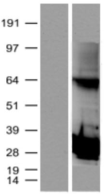 Western Blot: Proteasome subunit beta type 4 Overexpression Lysate [NBL1-14879] - Left: control (empty vector transfected control cell lysate); right: NBL1-14879.  Antibody: DDK antibody.