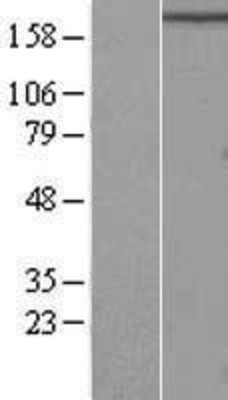 Western Blot: RB1CC1 Overexpression Lysate (Adult Normal) [NBL1-15184] Left-Empty vector transfected control cell lysate (HEK293 cell lysate); Right -Over-expression Lysate for RB1CC1.