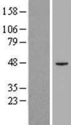 Western Blot: GPI8 Overexpression Lysate (Adult Normal) [NBL1-14399] Left-Empty vector transfected control cell lysate (HEK293 cell lysate); Right -Over-expression Lysate for GPI8.