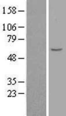 Western Blot: Monoamine Oxidase A Overexpression Lysate (Adult Normal) [NBL1-12841] Left-Empty vector transfected control cell lysate (HEK293 cell lysate); Right -Over-expression Lysate for Monoamine Oxidase A.