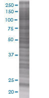 NUDT4 transfected lysate.