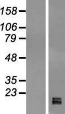 Western Blot: GPIHBP1 Overexpression Lysate (Adult Normal) [NBL1-11231] Left-Empty vector transfected control cell lysate (HEK293 cell lysate); Right -Over-expression Lysate for GPIHBP1.