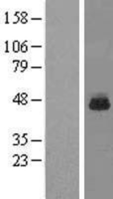 Western Blot: RPL3 Overexpression Lysate (Adult Normal) [NBL1-15523] Left-Empty vector transfected control cell lysate (HEK293 cell lysate); Right -Over-expression Lysate for RPL3.