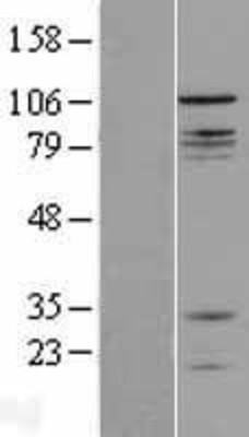 Western Blot: CNTROB Overexpression Lysate (Adult Normal) [NBL1-09339] Left-Empty vector transfected control cell lysate (HEK293 cell lysate); Right -Over-expression Lysate for CNTROB.