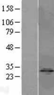 Western Blot: Protein phosphatase 1 inhibitor subunit 2 Overexpression Lysate (Adult Normal) [NBL1-14682] Left-Empty vector transfected control cell lysate (HEK293 cell lysate); Right -Over-expression Lysate for Protein phosphatase 1 inhibitor subunit 2.