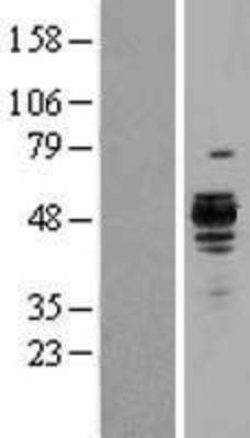 Western Blot: Hsp47 Overexpression Lysate (Adult Normal) [NBL1-15857] Left-Empty vector transfected control cell lysate (HEK293 cell lysate); Right -Over-expression Lysate for Hsp47.