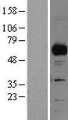 Western Blot: RBPJK Overexpression Lysate (Adult Normal) [NBL1-15231] Left-Empty vector transfected control cell lysate (HEK293 cell lysate); Right -Over-expression Lysate for RBPJK.