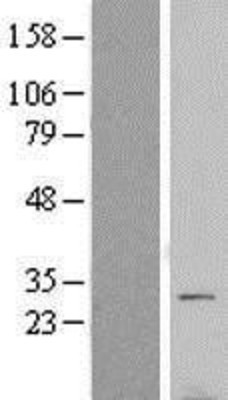 Western Blot: VTI1B Overexpression Lysate (Adult Normal) [NBL1-17769] Left-Empty vector transfected control cell lysate (HEK293 cell lysate); Right -Over-expression Lysate for VTI1B.
