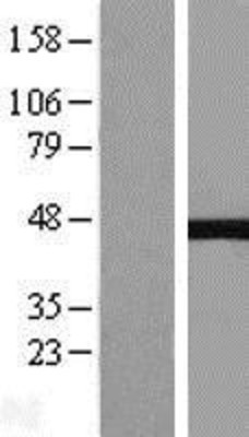 Western Blot: NEIL1 Overexpression Lysate (Adult Normal) [NBL1-13579] Left-Empty vector transfected control cell lysate (HEK293 cell lysate); Right -Over-expression Lysate for NEIL1.