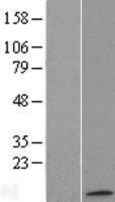 Western Blot: ATP synthase C mature Overexpression Lysate (Adult Normal) [NBL1-07823] Left-Empty vector transfected control cell lysate (HEK293 cell lysate); Right -Over-expression Lysate for ATP synthase C mature.