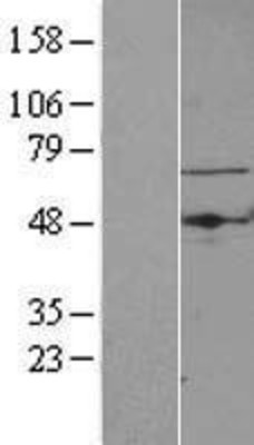 Western Blot: TBRG4 Overexpression Lysate (Adult Normal) [NBL1-16744] Left-Empty vector transfected control cell lysate (HEK293 cell lysate); Right -Over-expression Lysate for TBRG4.