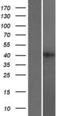 Western Blot: HNRPGT Overexpression Lysate (Adult Normal) [NBP2-10317] Left-Empty vector transfected control cell lysate (HEK293 cell lysate); Right -Over-expression Lysate for HNRPGT.
