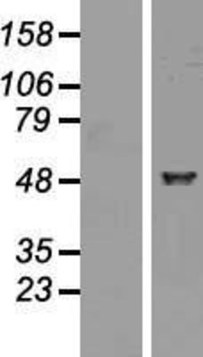 Western Blot: ALDH1A2 Overexpression Lysate (Adult Normal) [NBP2-10014] Left-Empty vector transfected control cell lysate (HEK293 cell lysate); Right -Over-expression Lysate for ALDH1A2.