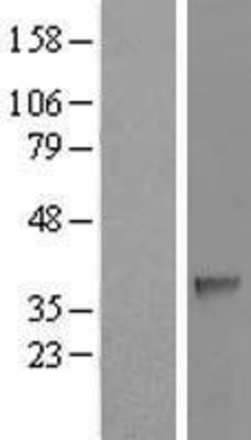 Western Blot: SDSL Overexpression Lysate (Adult Normal) [NBL1-15771] Left-Empty vector transfected control cell lysate (HEK293 cell lysate); Right -Over-expression Lysate for SDSL.