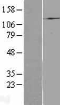 Western Blot: p110alpha/PIK3CA Overexpression Lysate (Adult Normal) [NBL1-14417] Left-Empty vector transfected control cell lysate (HEK293 cell lysate); Right -Over-expression Lysate for p110alpha/PIK3CA.