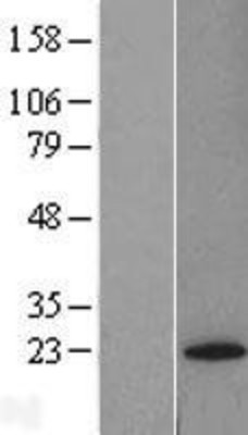 Western Blot: Glutathione Peroxidase 7 Overexpression Lysate (Adult Normal) [NBL1-11318] Left-Empty vector transfected control cell lysate (HEK293 cell lysate); Right -Over-expression Lysate for Glutathione Peroxidase 7.