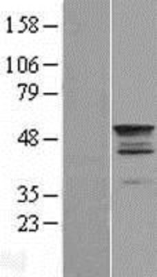 Western Blot: TEKT2 Overexpression Lysate (Adult Normal) [NBL1-16810] Left-Empty vector transfected control cell lysate (HEK293 cell lysate); Right -Over-expression Lysate for TEKT2.