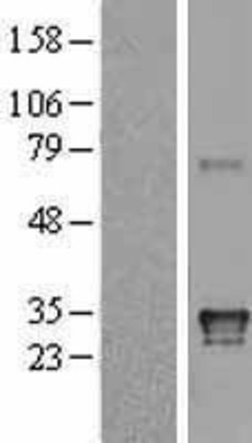 Western Blot: HLA DQA1 Overexpression Lysate (Adult Normal) [NBL1-11584] Left-Empty vector transfected control cell lysate (HEK293 cell lysate); Right -Over-expression Lysate for HLA DQA1.