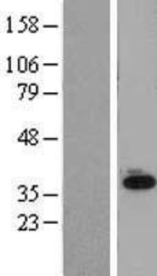 Western Blot: SLC25A11 Overexpression Lysate (Adult Normal) [NBL1-16047] Left-Empty vector transfected control cell lysate (HEK293 cell lysate); Right -Over-expression Lysate for SLC25A11.