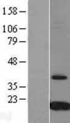 Western Blot: Prealbumin Overexpression Lysate (Adult Normal) [NBL1-17423] Left-Empty vector transfected control cell lysate (HEK293 cell lysate); Right -Over-expression Lysate for Prealbumin.