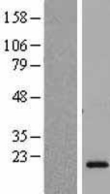Western Blot: CSH2 Overexpression Lysate (Adult Normal) [NBL1-09523] Left-Empty vector transfected control cell lysate (HEK293 cell lysate); Right -Over-expression Lysate for CSH2.