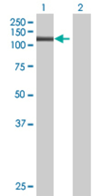 Lane 1: PMS2 transfected lysate (94.93 KDa) Lane 2: Non-transfected lysate.