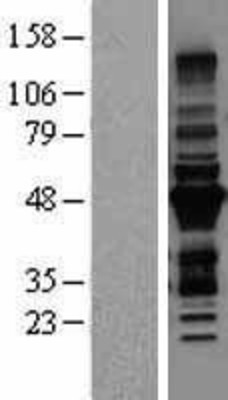Western Blot: MURF3 Overexpression Lysate (Adult Normal) [NBL1-17305] Left-Empty vector transfected control cell lysate (HEK293 cell lysate); Right -Over-expression Lysate for MURF3.