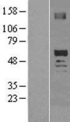 Western Blot: SCOT2 Overexpression Lysate (Adult Normal) [NBL1-14019] Left-Empty vector transfected control cell lysate (HEK293 cell lysate); Right -Over-expression Lysate for SCOT2.