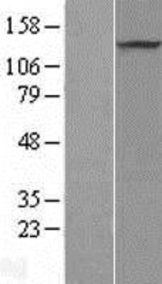 Western Blot: PRDM10 Overexpression Lysate (Adult Normal) [NBL1-14734] Left-Empty vector transfected control cell lysate (HEK293 cell lysate); Right -Over-expression Lysate for PRDM10.
