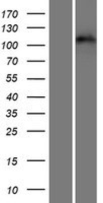 Western Blot: EPH Receptor A3 Overexpression Lysate (Adult Normal) [NBP2-10482] Left-Empty vector transfected control cell lysate (HEK293 cell lysate); Right -Over-expression Lysate for EPH Receptor A3.