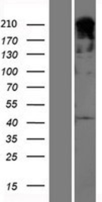 Western Blot: 53BP1 Overexpression Lysate (Adult Normal) [NBP2-10450] Left-Empty vector transfected control cell lysate (HEK293 cell lysate); Right -Over-expression Lysate for 53BP1.