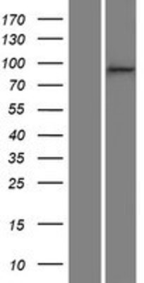 Western Blot: p120-catenin Overexpression Lysate (Adult Normal) [NBP2-10651] Left-Empty vector transfected control cell lysate (HEK293 cell lysate); Right -Over-expression Lysate for p120-catenin.