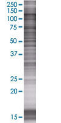 OSBPL5 transfected lysate.