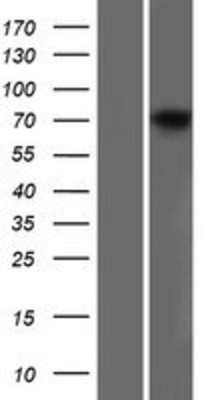 Western Blot: Dystrophin Overexpression Lysate (Adult Normal) [NBP2-10564] Left-Empty vector transfected control cell lysate (HEK293 cell lysate); Right -Over-expression Lysate for Dystrophin.
