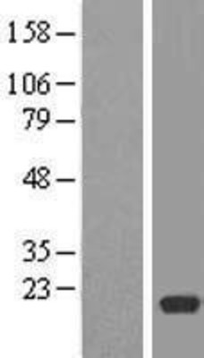 Western Blot: RPL12 Overexpression Lysate (Adult Normal) [NBP2-08989] Left-Empty vector transfected control cell lysate (HEK293 cell lysate); Right -Over-expression Lysate for RPL12.