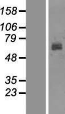 Western Blot: Tyrosinase Overexpression Lysate (Adult Normal) [NBP2-10667] Left-Empty vector transfected control cell lysate (HEK293 cell lysate); Right -Over-expression Lysate for Tyrosinase.
