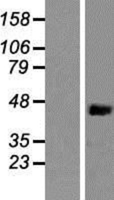 Western Blot: Nck Overexpression Lysate (Adult Normal) [NBP2-10428] Left-Empty vector transfected control cell lysate (HEK293 cell lysate); Right -Over-expression Lysate for Nck.