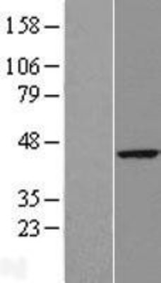 Western Blot: RTN4IP1 Overexpression Lysate (Adult Normal) [NBL1-15613] Left-Empty vector transfected control cell lysate (HEK293 cell lysate); Right -Over-expression Lysate for RTN4IP1.