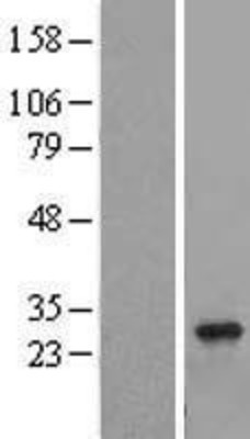 Western Blot: RAB8B Overexpression Lysate (Adult Normal) [NBL1-15091] Left-Empty vector transfected control cell lysate (HEK293 cell lysate); Right -Over-expression Lysate for RAB8B.