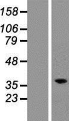Western Blot: RASSF2 Overexpression Lysate (Adult Normal) [NBP2-09867] Left-Empty vector transfected control cell lysate (HEK293 cell lysate); Right -Over-expression Lysate for RASSF2.