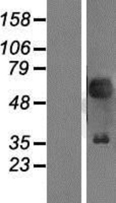 Western Blot: Pax2 Overexpression Lysate (Adult Normal) [NBP2-09796] Left-Empty vector transfected control cell lysate (HEK293 cell lysate); Right -Over-expression Lysate for Pax2.