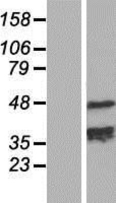 Western Blot: TCHP Overexpression Lysate (Adult Normal) [NBP2-09696] Left-Empty vector transfected control cell lysate (HEK293 cell lysate); Right -Over-expression Lysate for TCHP.