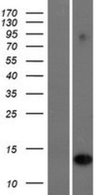 Western Blot: IFI6 Overexpression Lysate (Adult Normal) [NBP2-09907] Left-Empty vector transfected control cell lysate (HEK293 cell lysate); Right -Over-expression Lysate for IFI6.