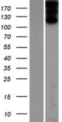 Western Blot: ZFYVE9 Overexpression Lysate (Adult Normal) [NBP2-09843] Left-Empty vector transfected control cell lysate (HEK293 cell lysate); Right -Over-expression Lysate for ZFYVE9.