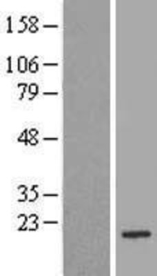 Western Blot: Bad Overexpression Lysate (Adult Normal) [NBP2-09800] Left-Empty vector transfected control cell lysate (HEK293 cell lysate); Right -Over-expression Lysate for Bad.