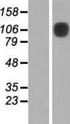 Western Blot: DDR1 Overexpression Lysate (Adult Normal) [NBP2-09858] Left-Empty vector transfected control cell lysate (HEK293 cell lysate); Right -Over-expression Lysate for DDR1.