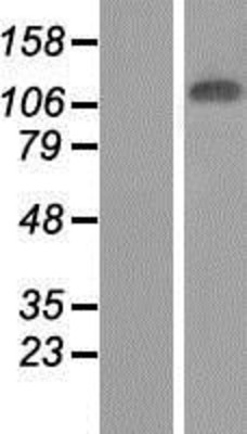 Western Blot: JMJD7 Overexpression Lysate (Adult Normal) [NBP2-07796] Left-Empty vector transfected control cell lysate (HEK293 cell lysate); Right -Over-expression Lysate for JMJD7.